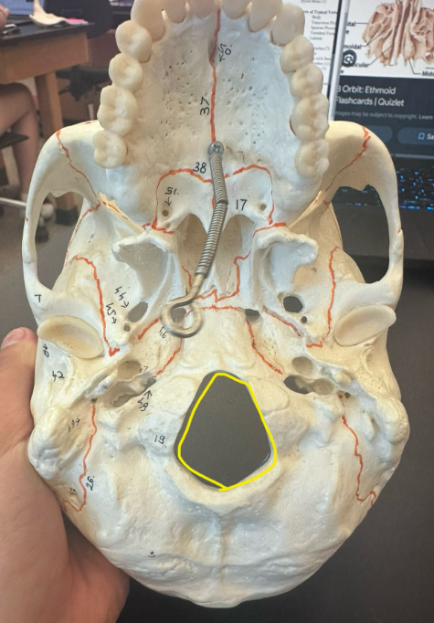 <p>What is circled in yellow?</p>