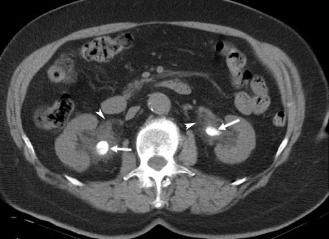 <p>What imaging is used to visualize <strong>gallstones</strong>?</p>