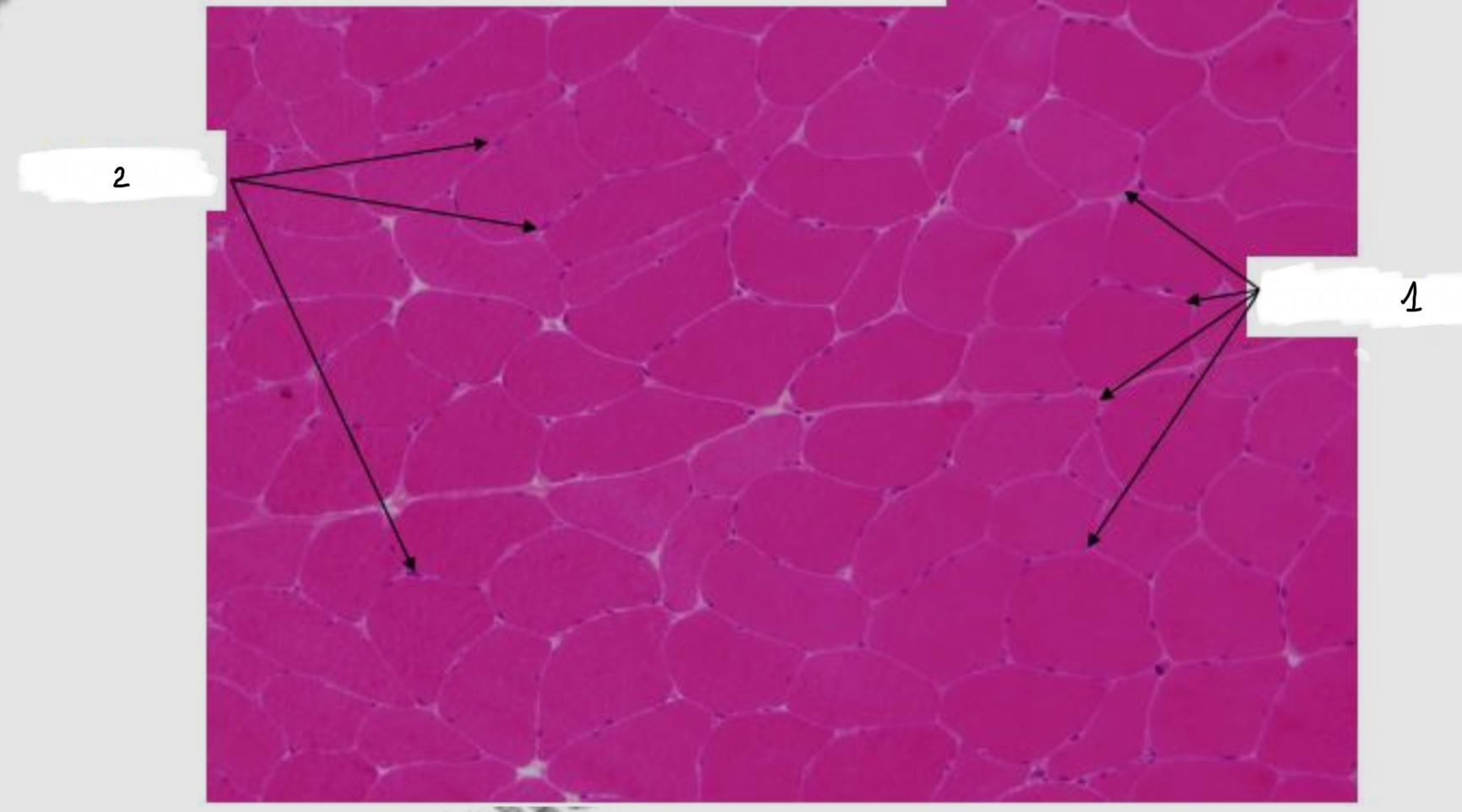 <p>Qu’observe sur cette coupe histologique de muscle strié squelettique après coloration HES et remplir la légende</p>