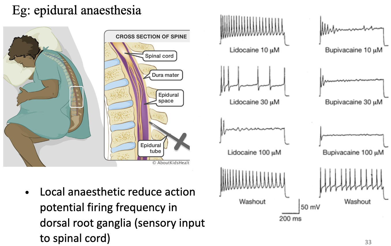 <ul><li><p>Explains how drugs (e.g ., anesthetics) affect neural activity.</p></li><li><p><strong>Local anesthetics</strong> (like epidural drugs) block Na+ channels → reduce AP firing.</p></li><li><p>Washout makes it reversible.</p></li><li><p>Reduce AP firing frequency in dorsal root ganglia (sensory input to spinal cord)</p></li></ul><p></p>