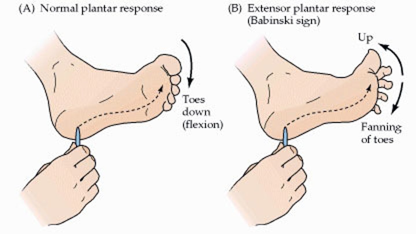 <p>-stimulus: stroke sole of foot<br>-normal response: downward curling (flexion) of toes<br>-tests integrity of L4-S2<br>-can be artificially triggered by stroking sole of foot</p>