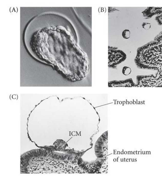 <p>The blastocyst (comes after the blastula) must shed the ZP &gt; hatching</p>