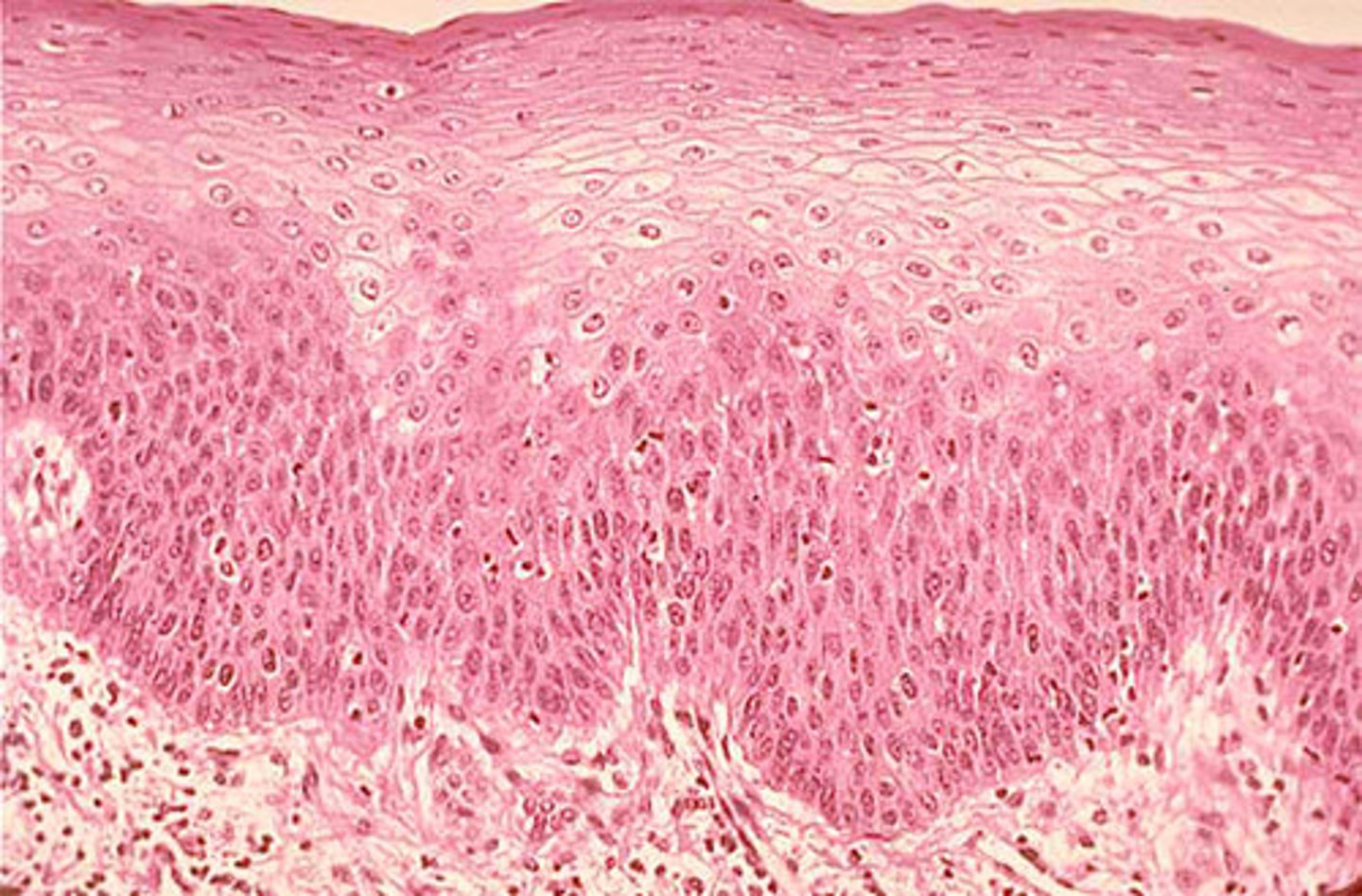 <p>Function - Protects underlying tissues in areas subject to abrasion.</p><p>Location - Nonkeratenized type forms moist linings of esophagus, mouth, and vagina. Keratenized type forms the epidermis of the skin (a dry membrane).</p>