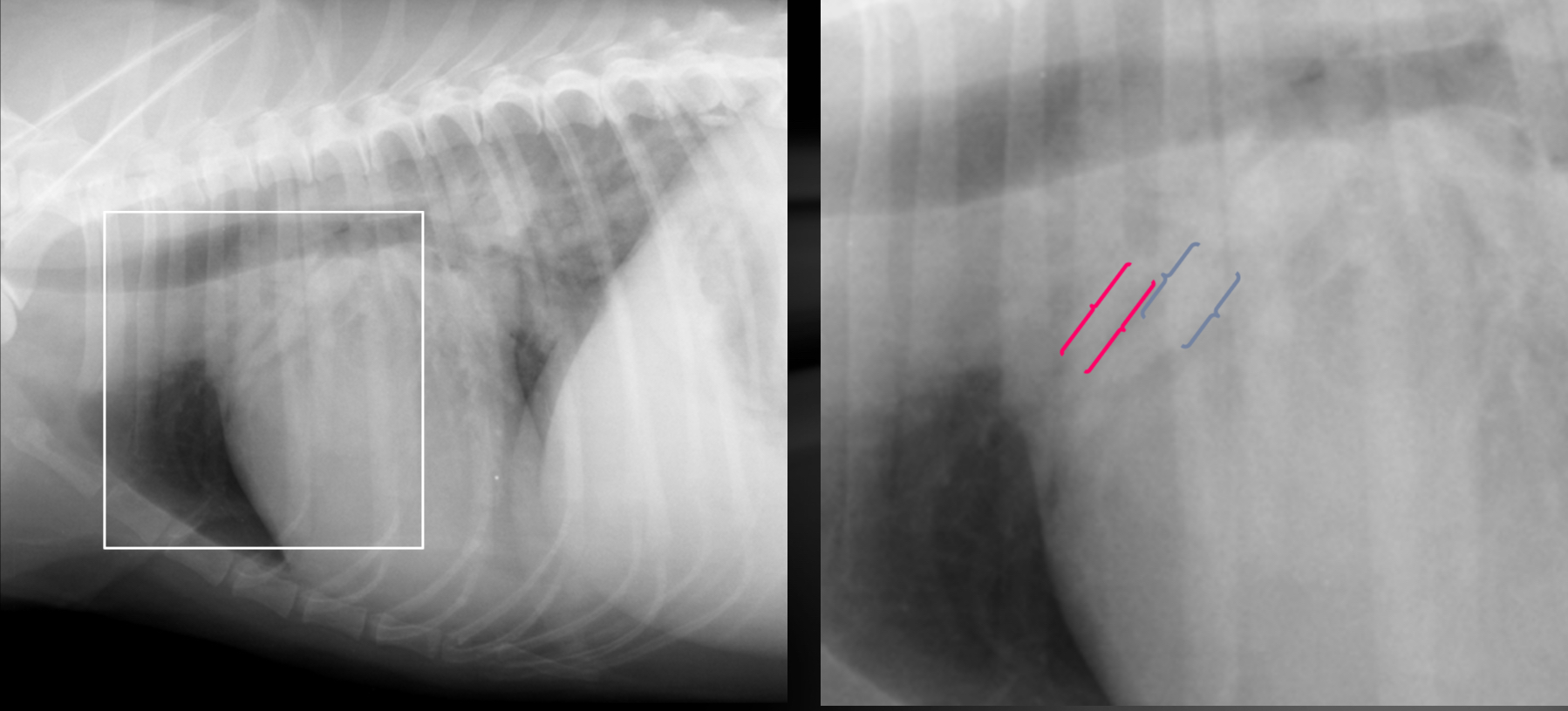 <p>-pulmonary vessel enlargement/congestion</p><p>-pulmonary veins > pulmonary arteries</p><p>-both arteries and veins are increased in size (esp cats)</p>