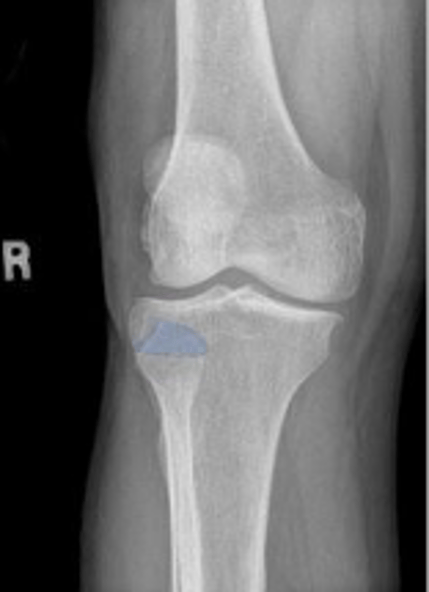 <p>What is outlined?</p>