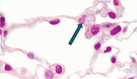 <p>In the micrograph of the alveolus, which type of cell is indicated by the arrow?</p>