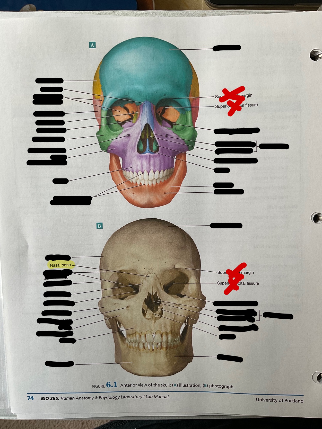 Nasal