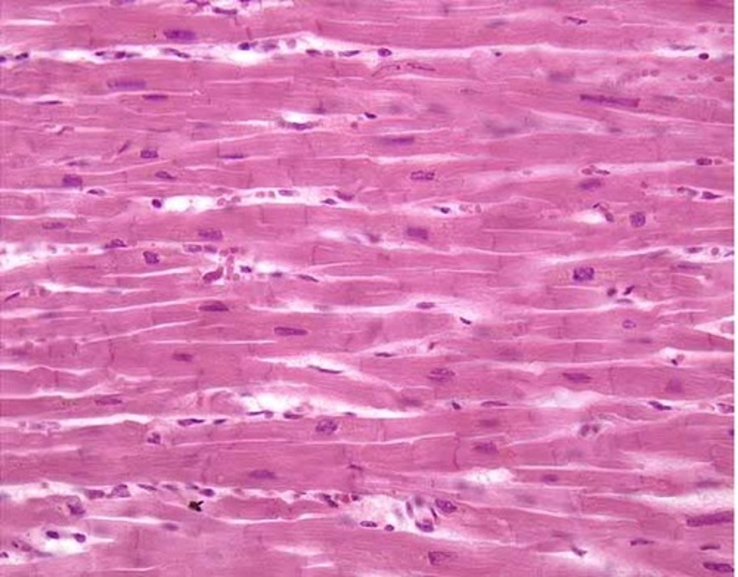 <p>A muscle that appears banded.</p>