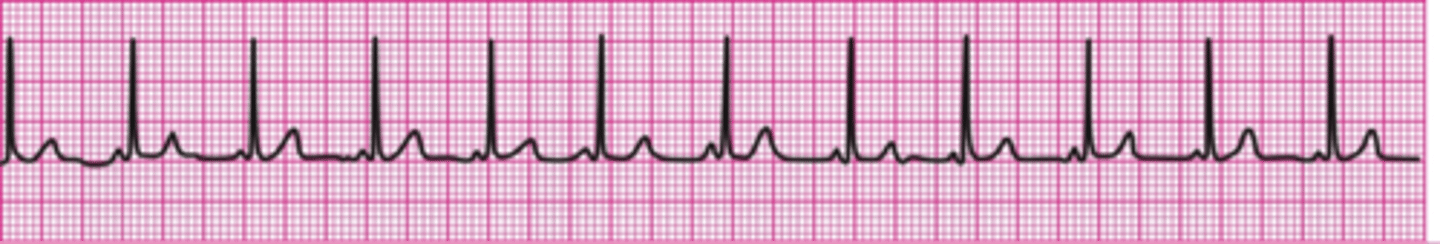 <p>Resume compressions</p>