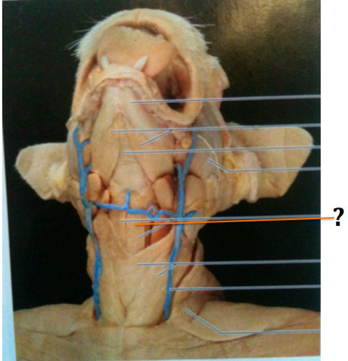 <p>What muscle is this?</p><p>Origin?</p><p>Insertion?</p><p>Function?</p><p>Innervation?</p>