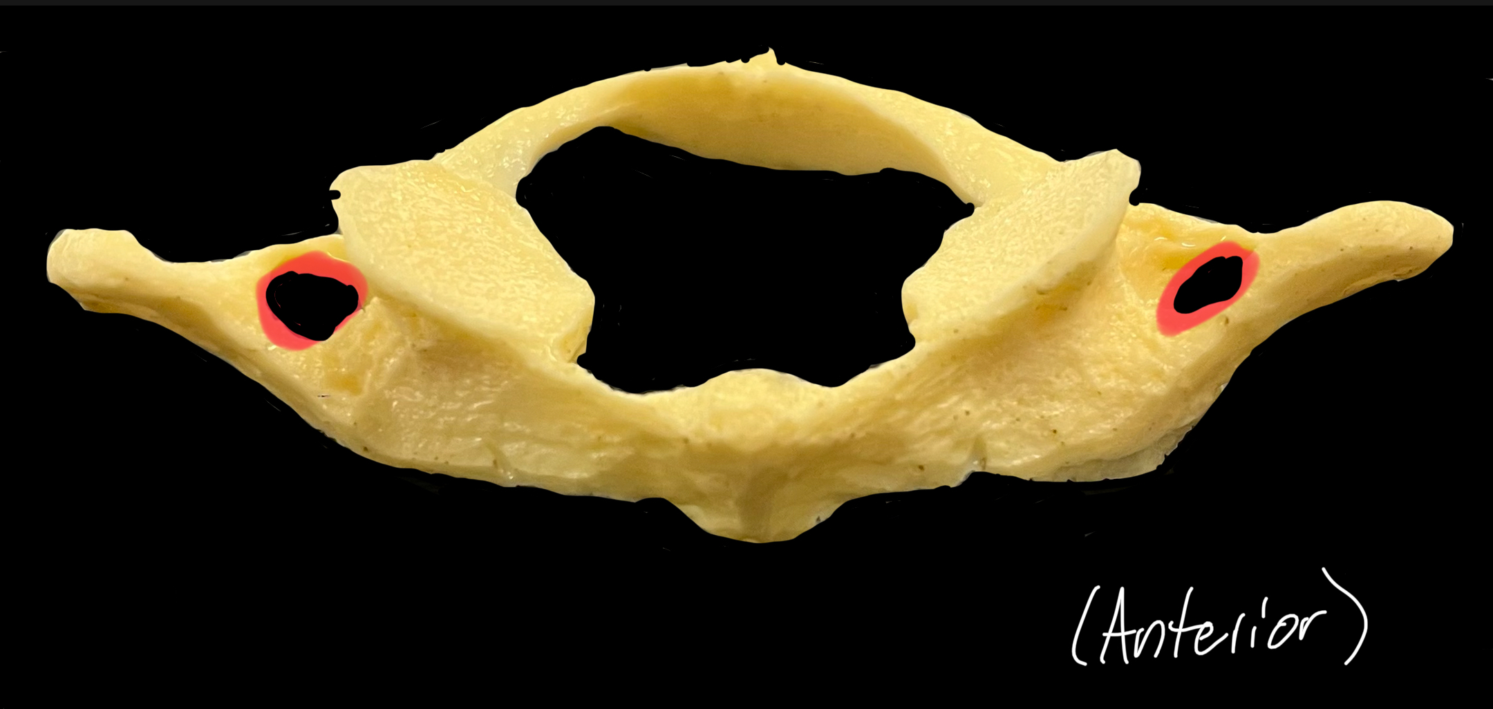 What is highlighted in red? 

What goes through it?