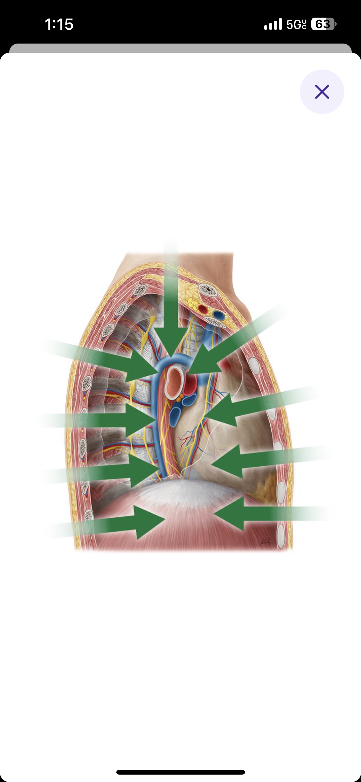 <p>Refers to something located inside the body within an organ or structure</p>