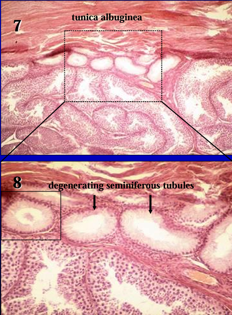 <p>Figure 7 (20X) and Figure 8 (50X) show in increasing magnification the <strong>tunica albuginea</strong> (dense connective tissue), <strong>degenerating seminiferous tubules</strong>, and <strong>normal seminiferous tubules.</strong></p>