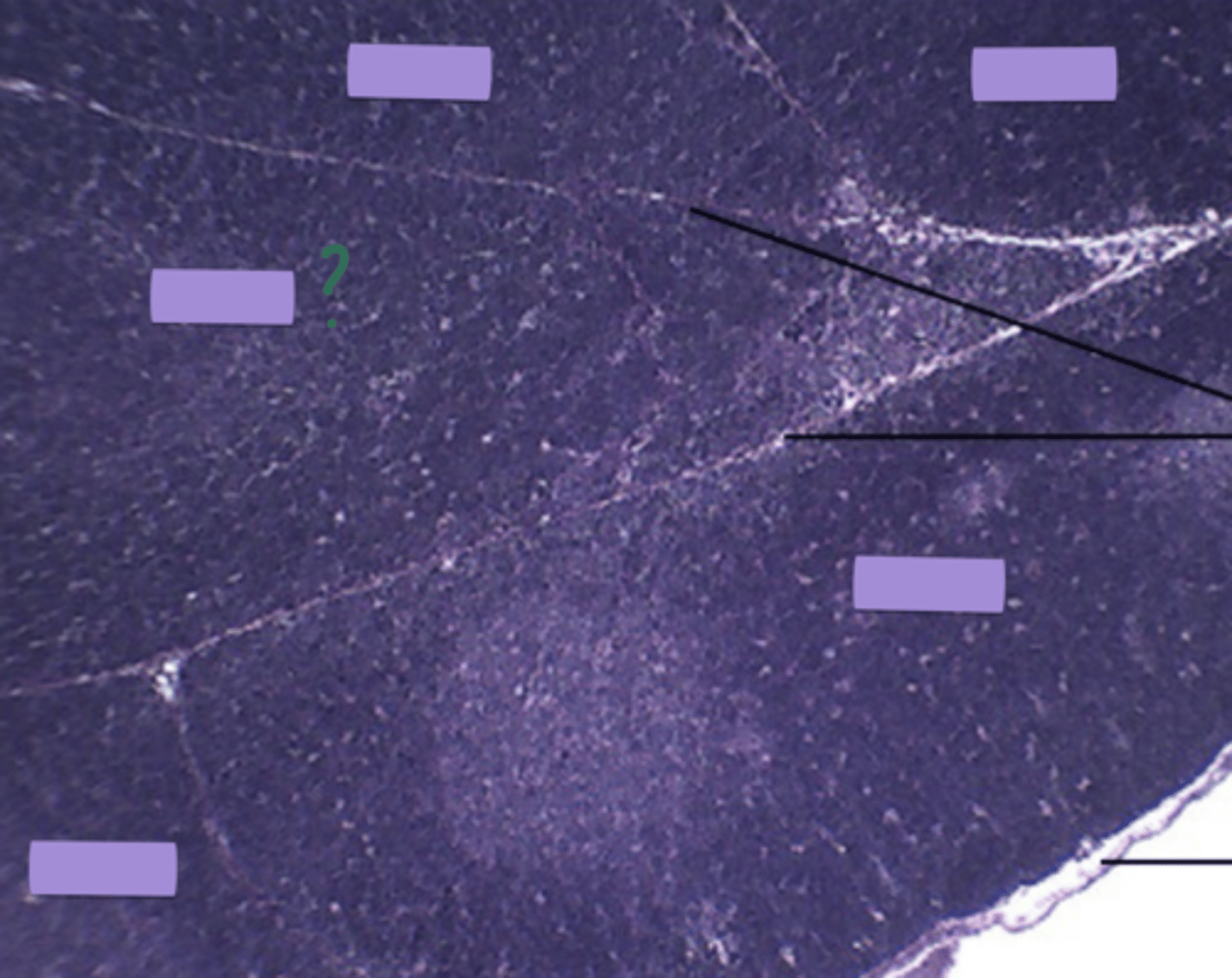 <p>gland and structure</p>