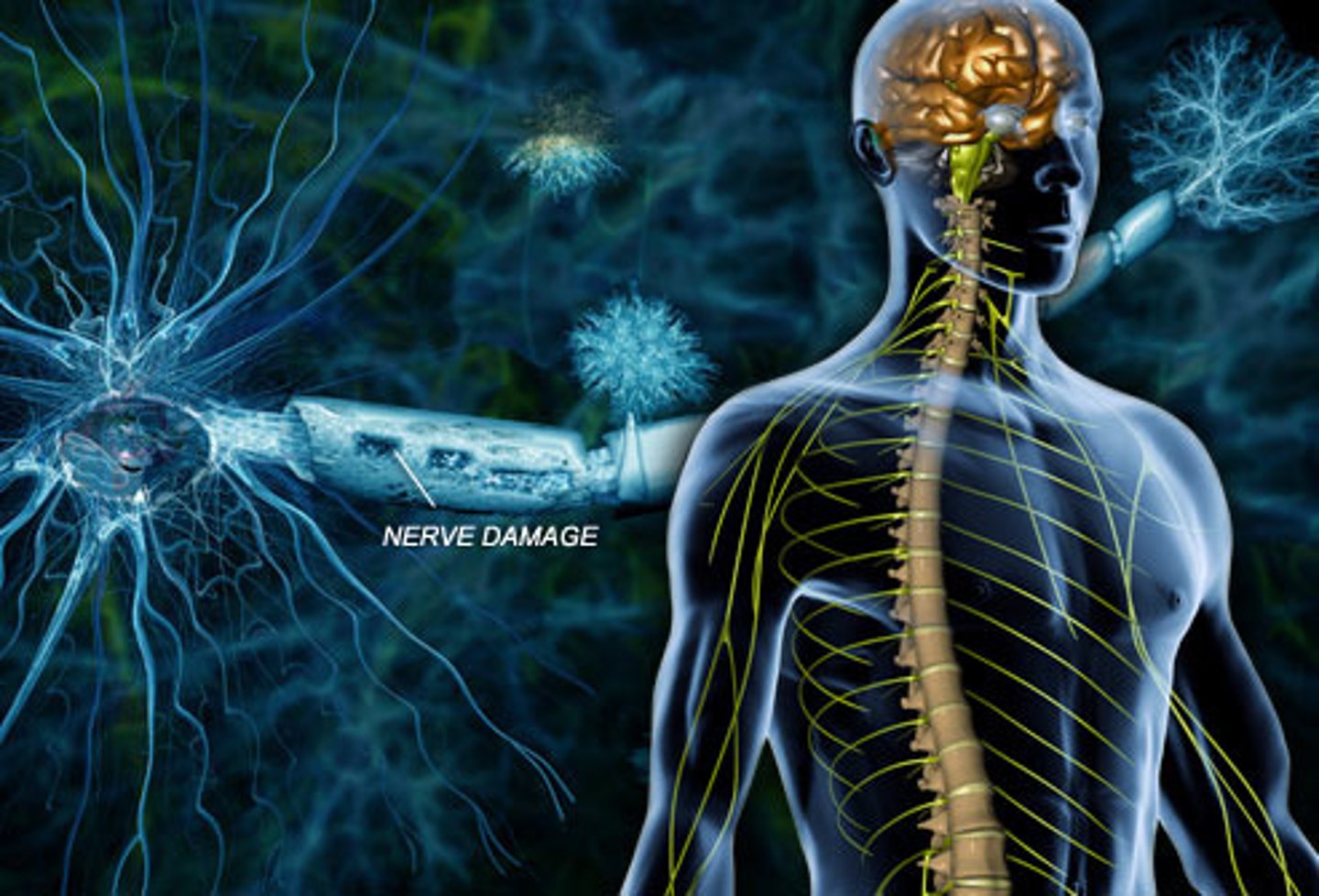 <p>dysfunction in peripheral nerves</p>