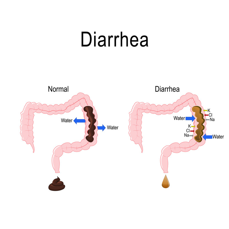 <p>Diarrhea</p>