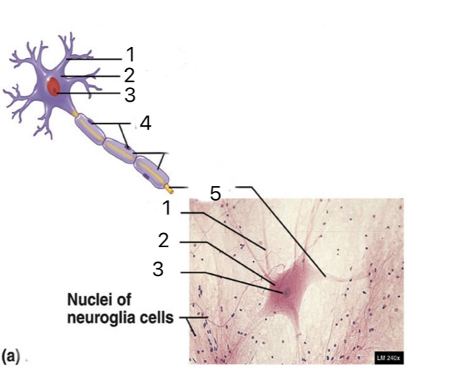 <p>Label all terms</p>