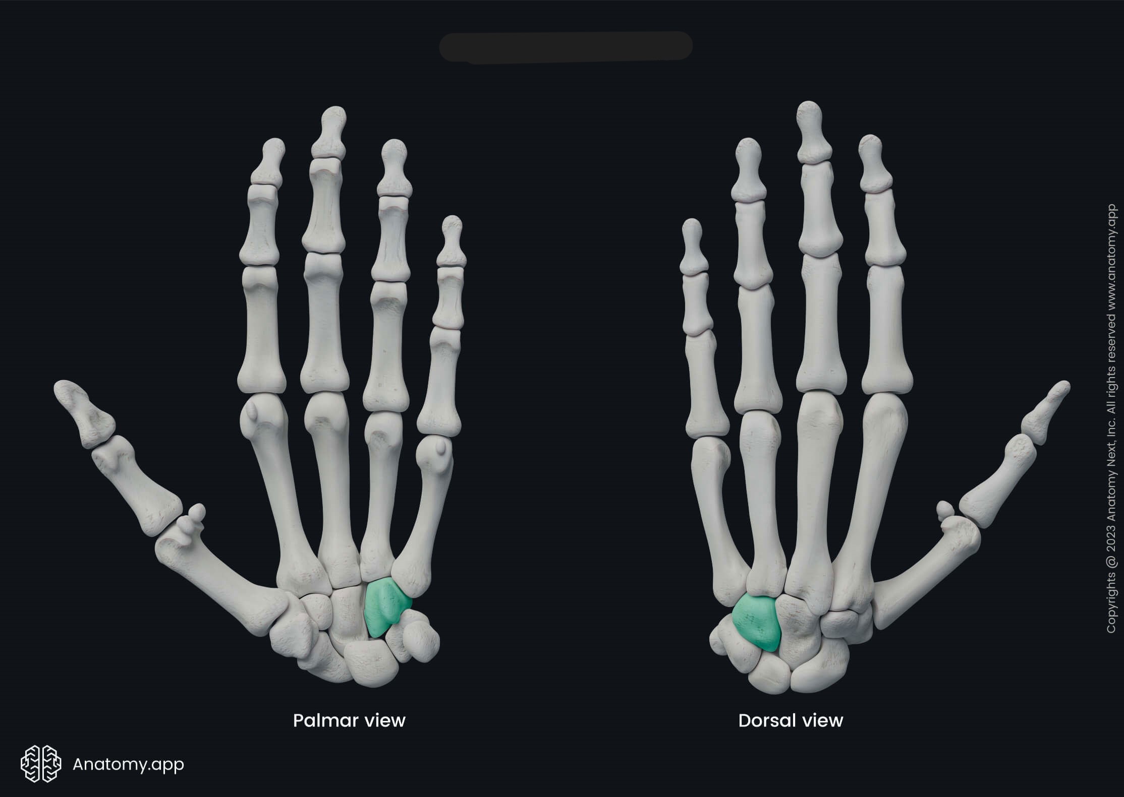 <p>What bone is this?</p>