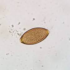 <p><span>Scientific </span>Name: Trichuris vulpis; Shape: Football/Lemon; Shell: Thick; Size: 70-90; Special Features: Bipolar plugs.</p>