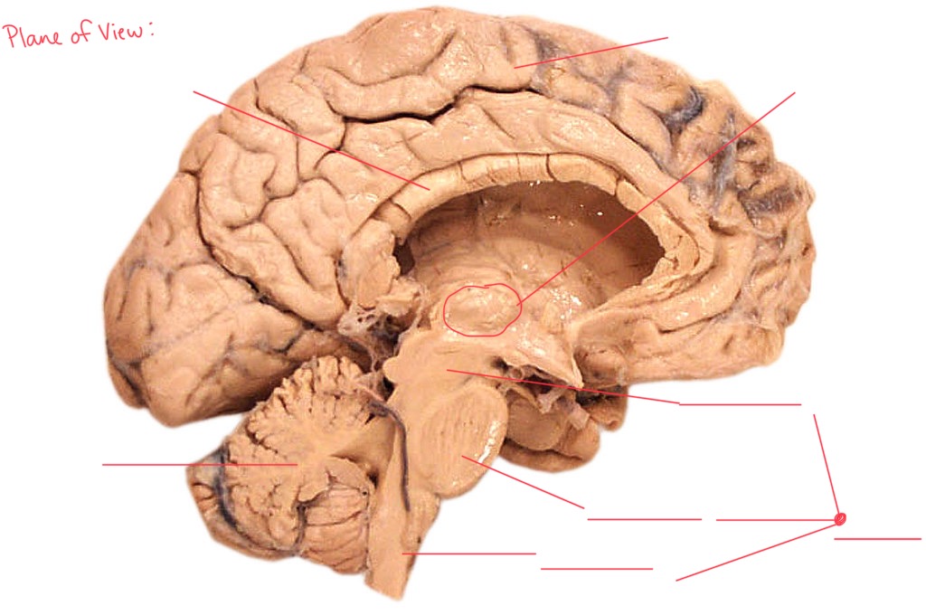 <p>Label this image, include which plane of view you are viewing. </p>