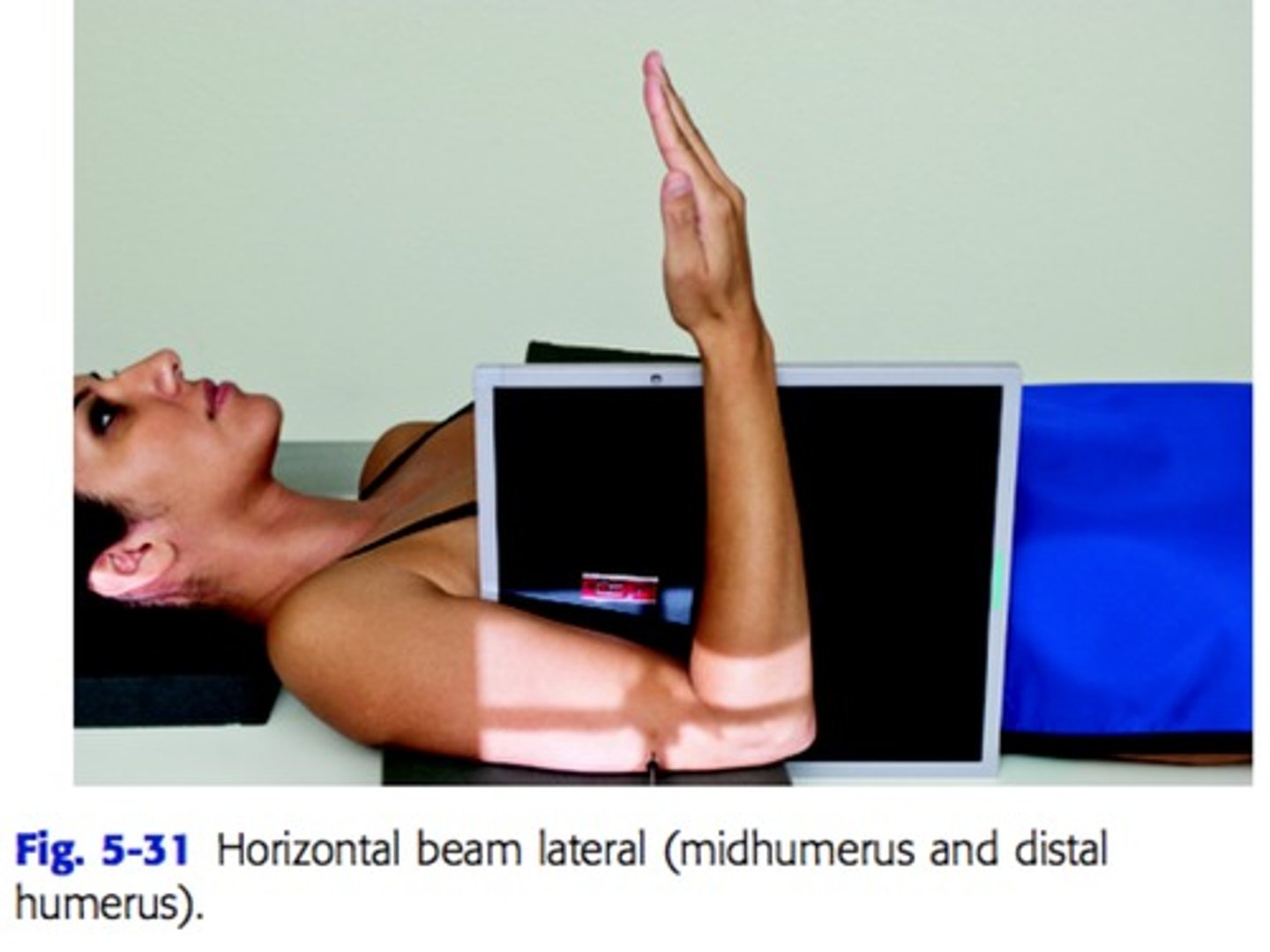 <p>perpendicular to midpoint of distal two-thirds of humerus</p>