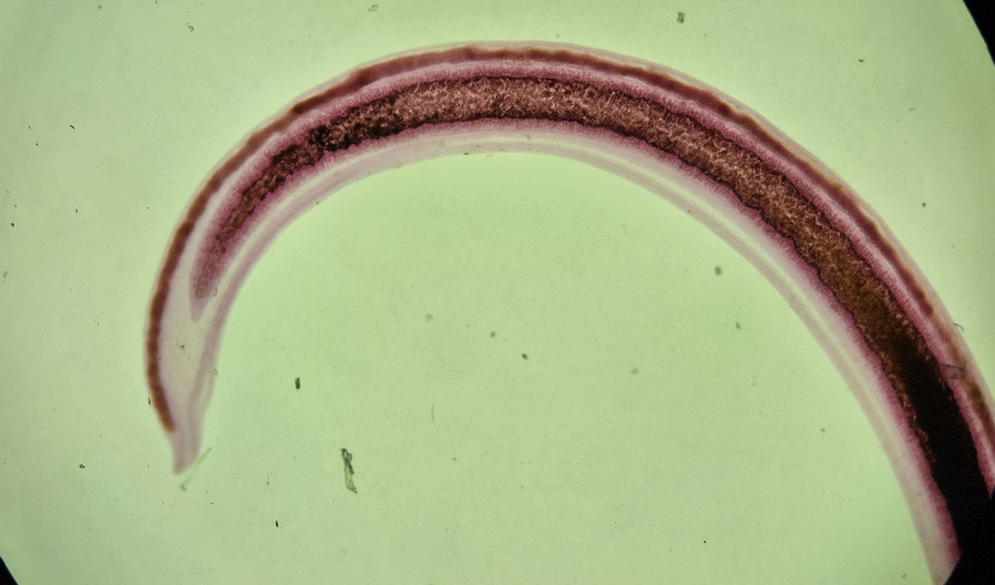 <p><span data-name="microscope" data-type="emoji">🔬</span><span data-name="petri_dish" data-type="emoji">🧫</span><strong><span> </span>Na podstawie zdjęcia preparatu:</strong></p><p></p><ul><li><p><span data-name="book" data-type="emoji">📖</span><span> </span>rozpoznaj gatunek pasożyta;</p></li></ul><p></p><ul><li><p><span data-name="recycle" data-type="emoji">♻</span><span> </span>rozpoznaj wszystkie formy rozwojowe;</p></li></ul><p></p><ul><li><p><span data-name="microbe" data-type="emoji">🦠</span><span> </span>wskaż organelle i cechy charakterystyczne dla danego gatunku;</p></li></ul><p></p><ul><li><p><span data-name="mask" data-type="emoji">😷</span><span> </span>nazwij chorobę, którą pasożyt wywołuje.</p></li></ul><p></p>