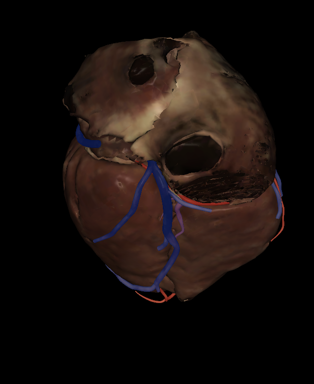 <p>Name the structure highlighted (purple)</p>