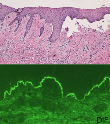 <p>What does DIF show in MMP?</p>