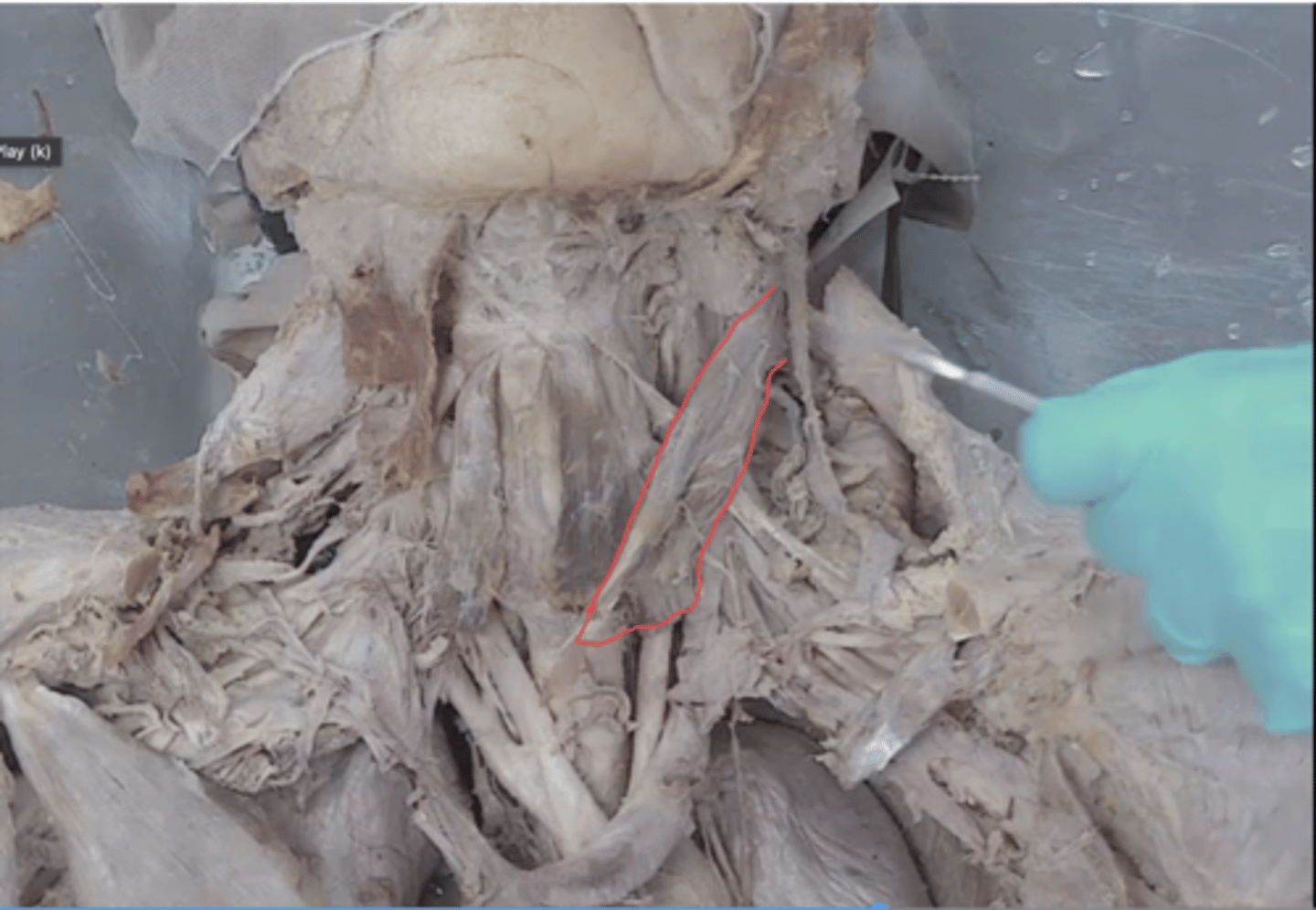 <p>identify this muscle</p>