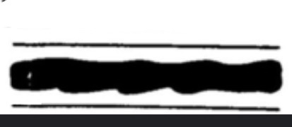 <p>What type of animal medulla is this? </p>