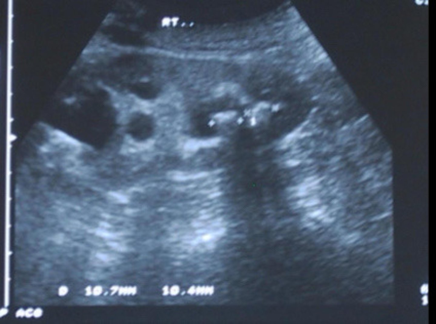 <p>What does this image show</p>