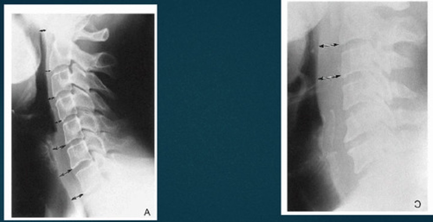 <p>What are we looking at?</p>