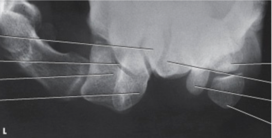 <p>What projection, position, and anatomy is this?</p>