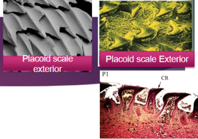 <p>What are placoid scales in cartilaginous fishes (chondrithyes)</p>