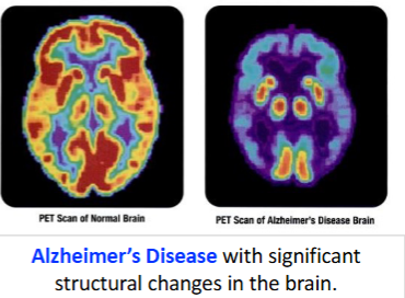 <p>Neurocognitive disorders are acquired (cognitive deficit was not present at birth)<br><br>Attributed to:</p><ul><li><p>Brain injury</p></li><li><p>Disease<br>substance/Medication use</p></li></ul><p></p>