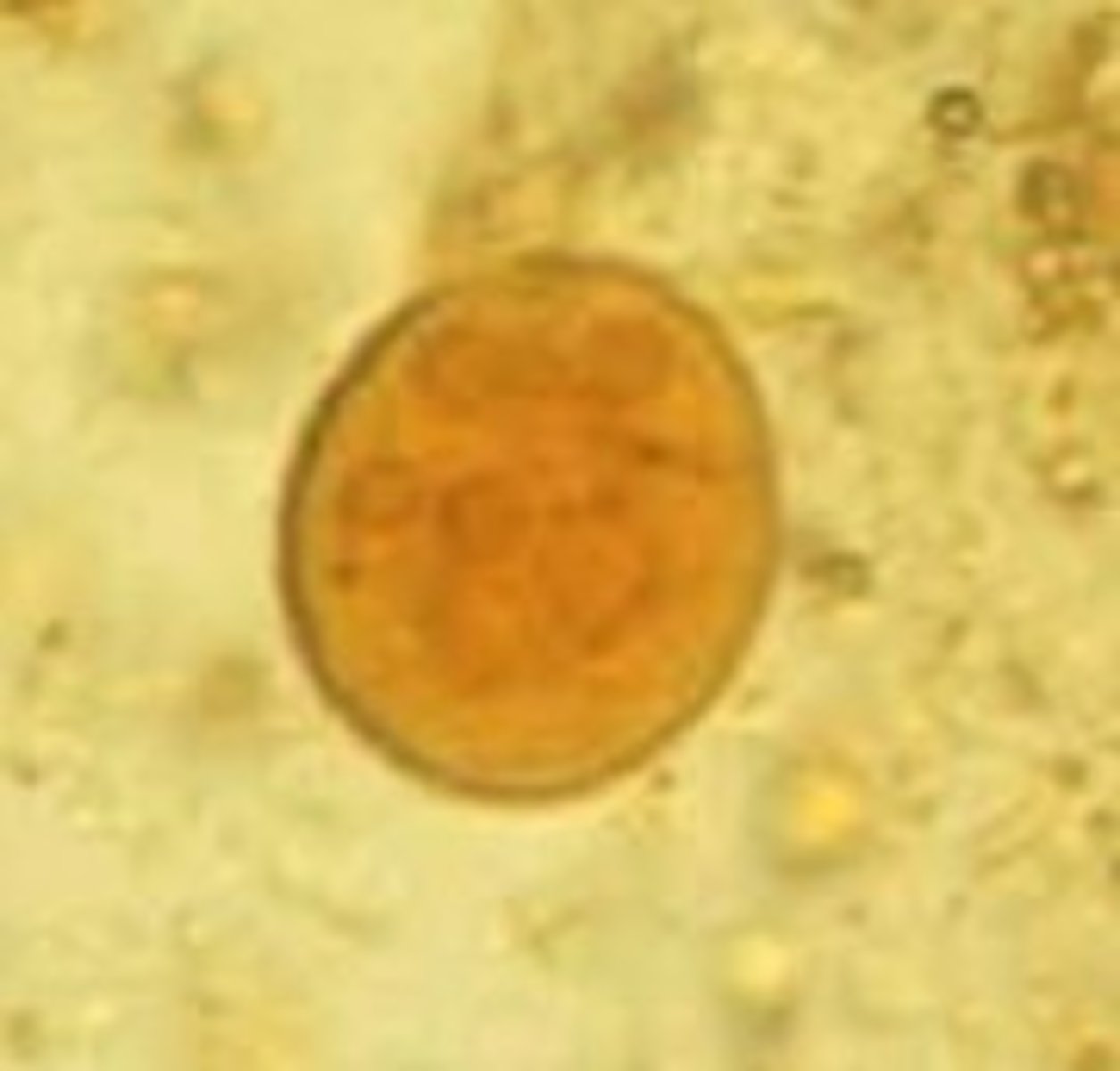 <p>Identify the parasite</p>