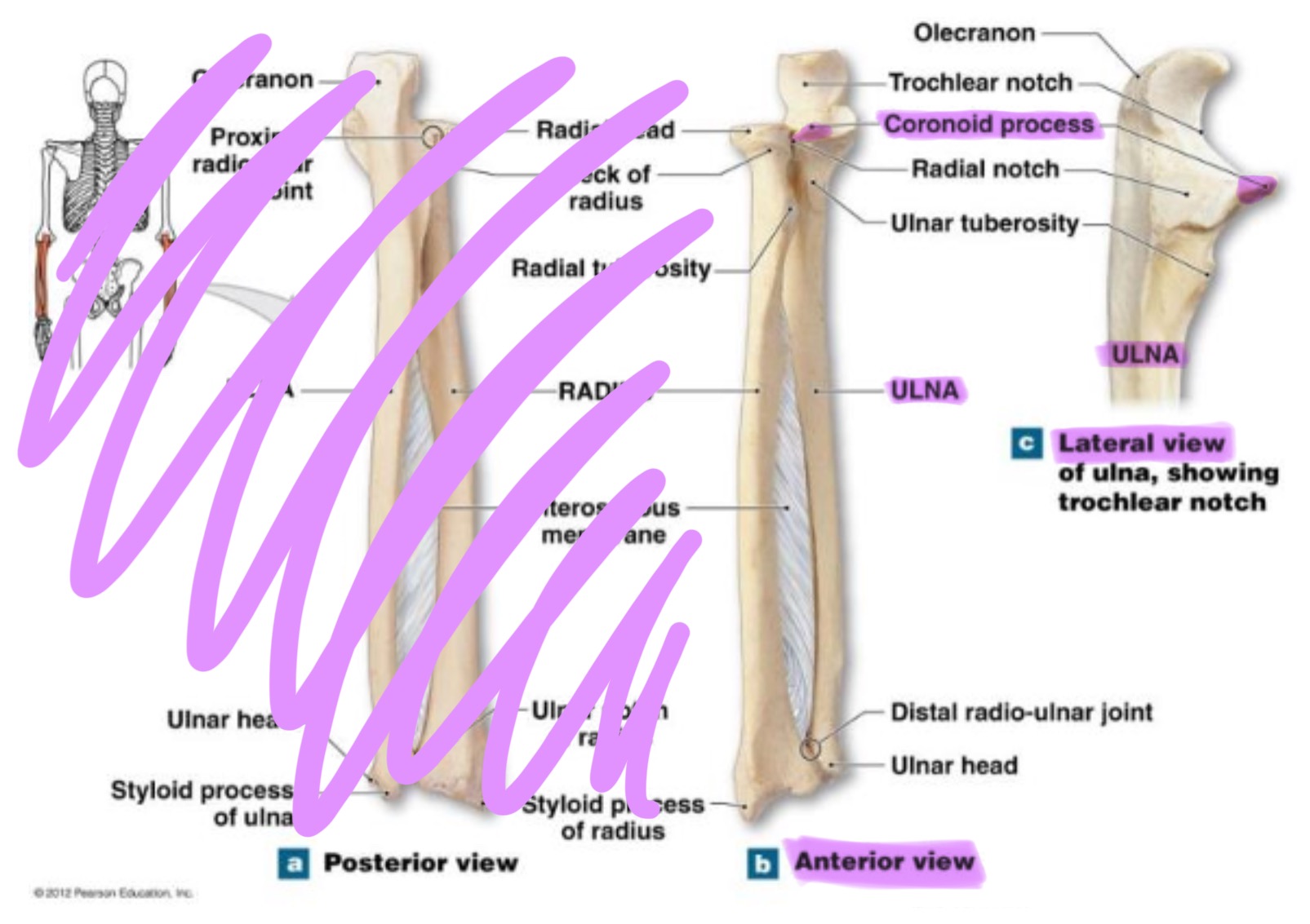 <p>triangular projection on anterior side of proximal ulna; fits into coronoid fossa of humerus when elbow is flexed & provides attachment for brachalis muscle</p>