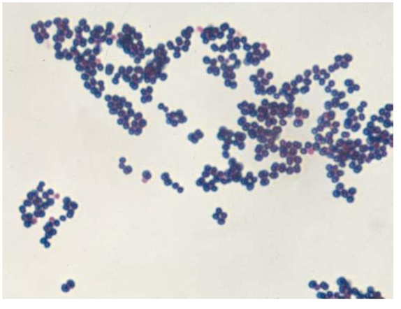 <p>gram positive cocci in clusters</p>