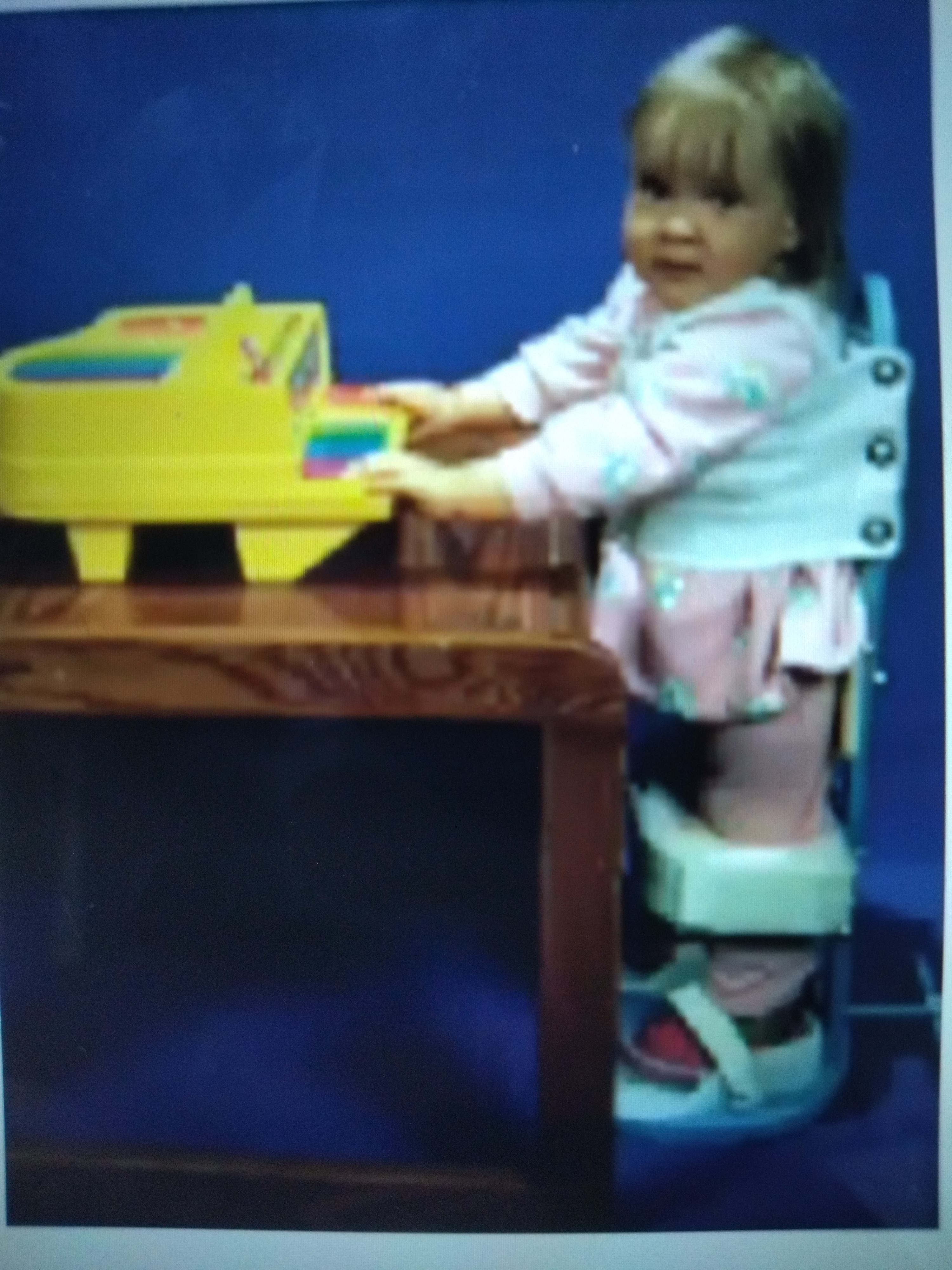 * Initial use is from 8 to 15 months
* Used after caster cart
* Used if patient is able to pull themselves up
* Has broad base, posterior non-articulated uprise, anterior leg band, and posterior thoracolumbar band