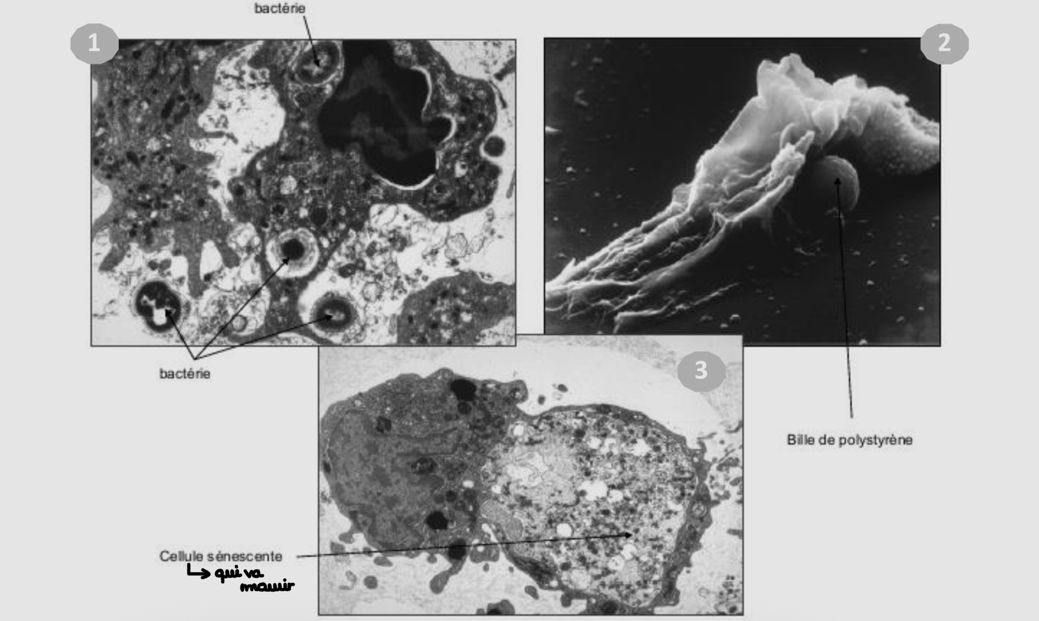 <p>À quoi correspond chaque observation microscopique </p>