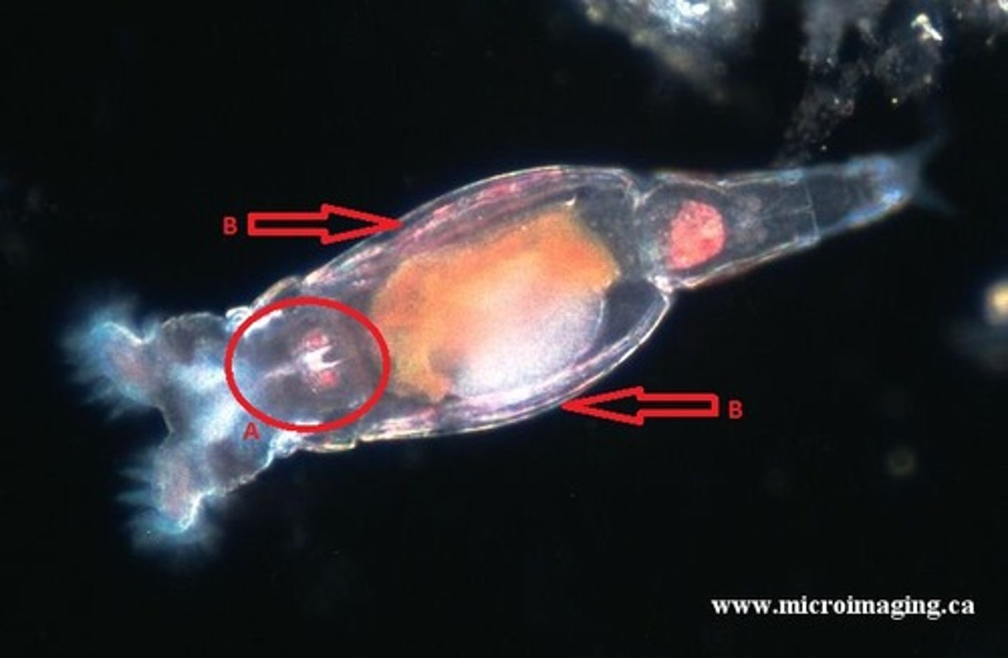 <p>the muscular pharynx in rotifers</p>
