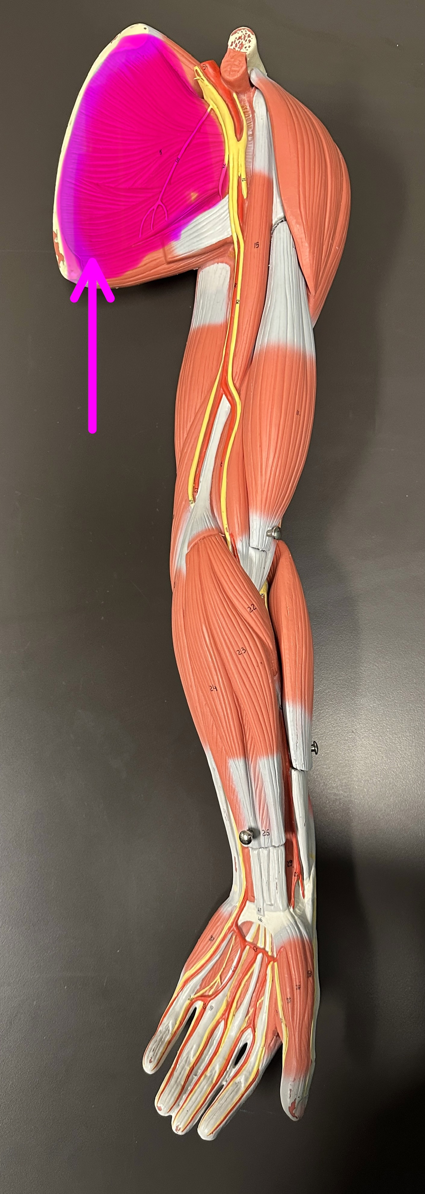 <p>What is the highlighted structure</p>