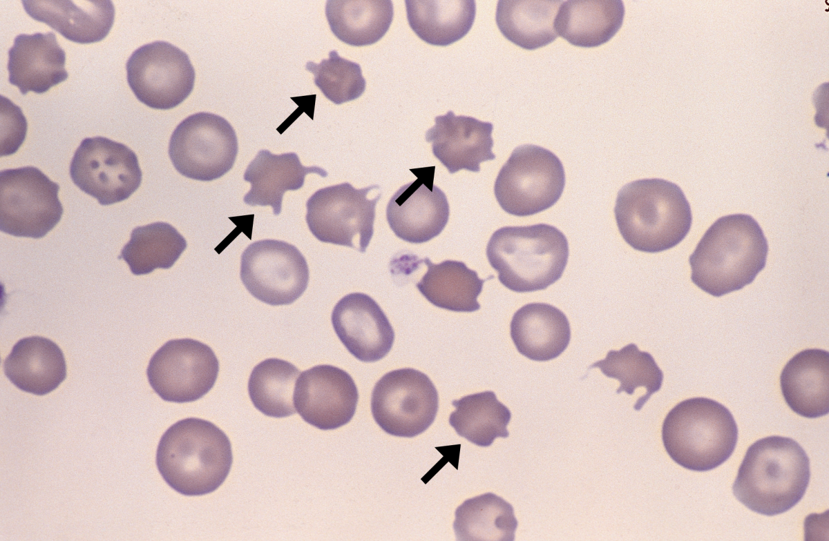 <p>Acanthocyte</p>