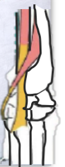<p><strong>Origin - </strong>Lateral epicondyle of humerus </p><p></p><p><strong>Insertion - </strong>the metacarpal bones</p><p></p><p><strong>Location - </strong>CRANIAL aspect of antebrachium, becomes a tendon once reaching the carpus </p><p></p><p><strong>Function -</strong> in the name… extensor carpi = CARPAL<strong> EXTENSOR&nbsp;</strong></p><p></p><p><strong>Nerve supply -</strong> also in the name; Radial nerve&nbsp;</p><p></p><p><strong>Unique feature -</strong> has a small,<u> oblique</u>&nbsp;muscle that runs over the tendon portion of the carpi radialis&nbsp;(see image)</p>