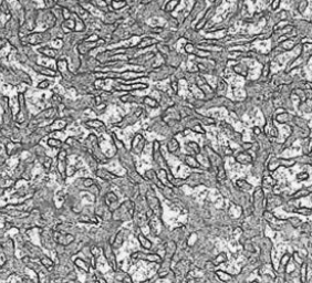 <p>series of flattened membrane bound compartments with no ribosomes, carry out lipid synthesis, metabolism and membrane formation</p>