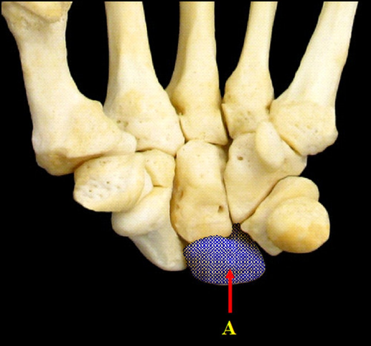 <p>Bone proximal of all wrist bones and medial as well.</p>