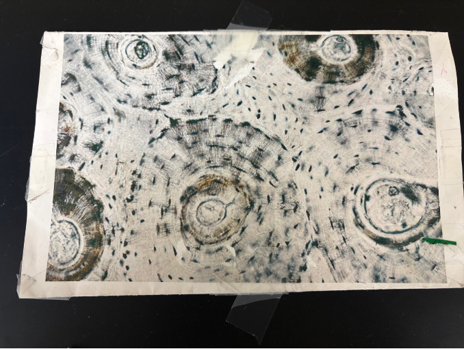 <p>What kind of bone/tissue/cartilage is this?</p>