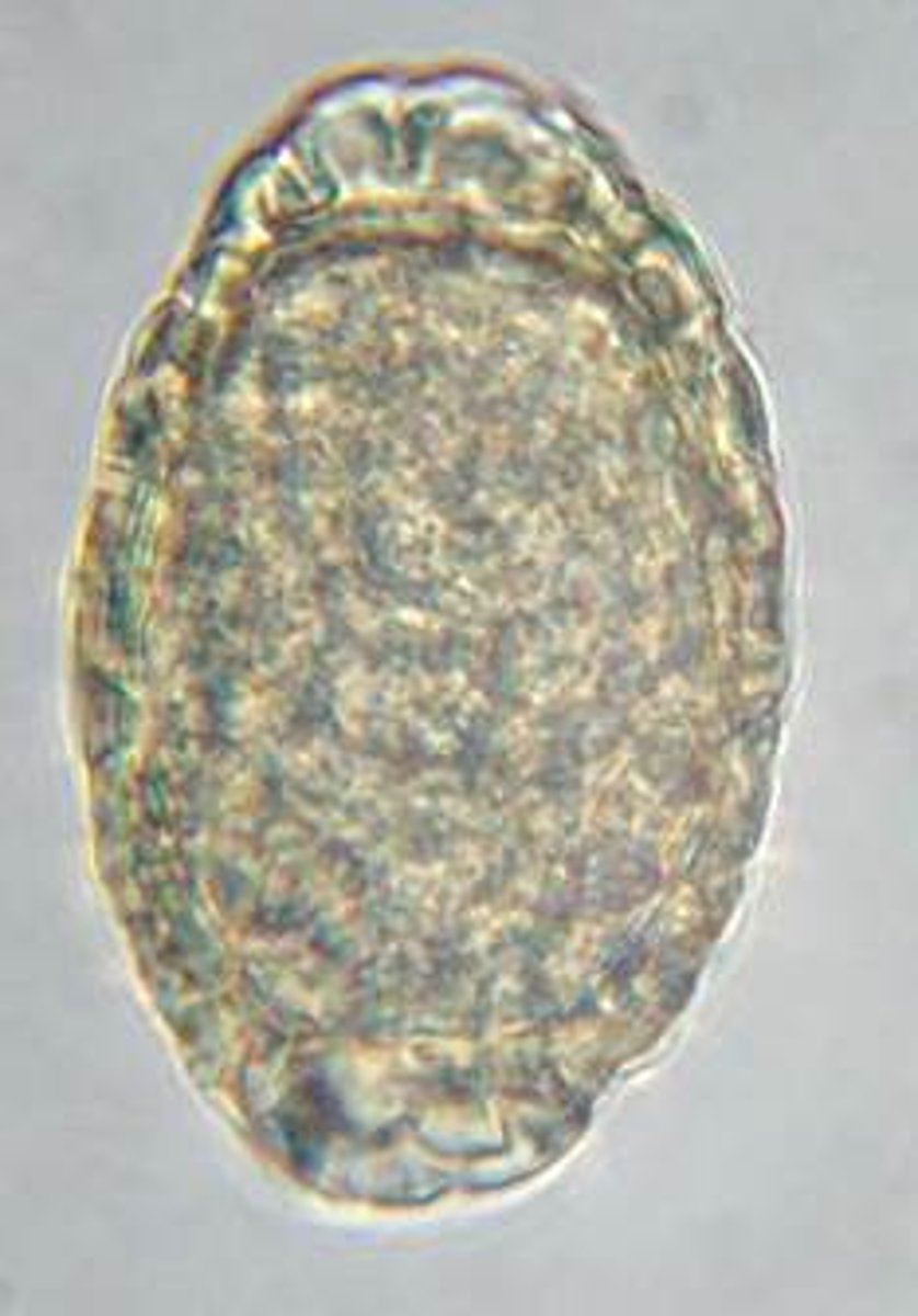 <p>What parasite produced this egg found in the urine sediment of a dog living in Northern Minnesota?</p>