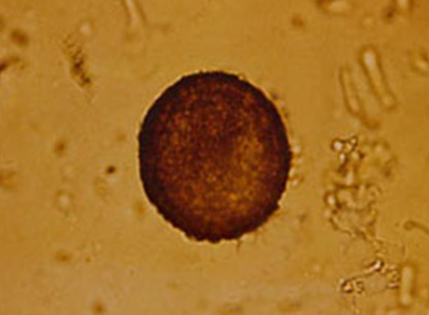 <ol><li><p>SN</p></li><li><p>PS</p></li><li><p>DH</p></li></ol><p></p>