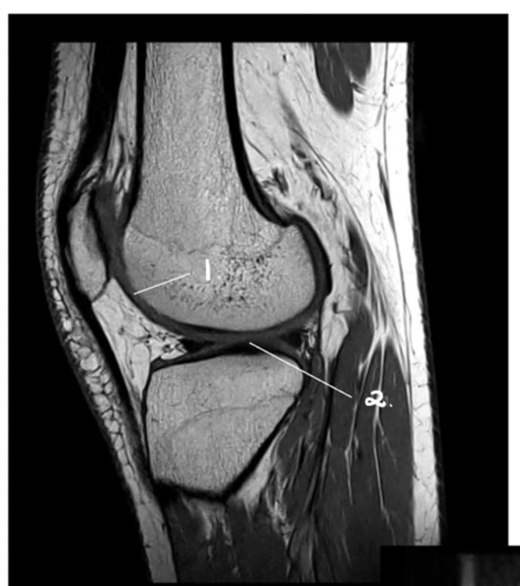 <p>Label 1 &amp; 2.</p>